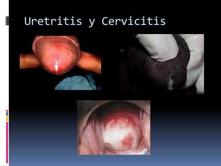 Enfermedades de transmision sexualidad pdf picture 31